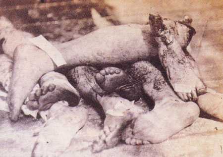 Civil War Casualties.jpg