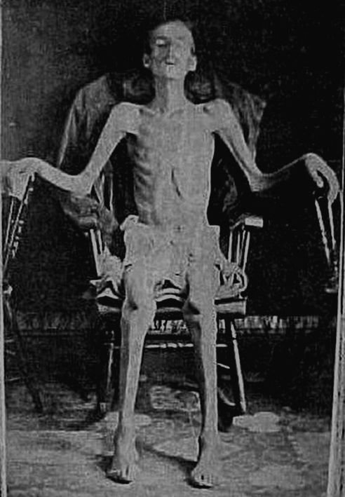 Civil War Prisoner.jpg